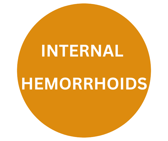 Hemorrhoids Bnh Hospital Hemorrhoids Bnh Hospital