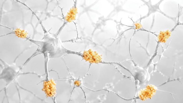 Anti-Amyloid